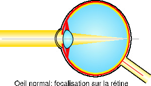 oeil-normal